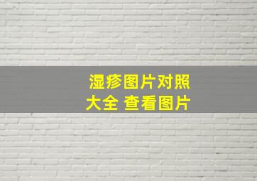 湿疹图片对照大全 查看图片